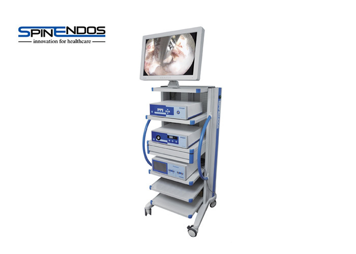 高(gāo)清內(nèi)窺鏡攝像系統